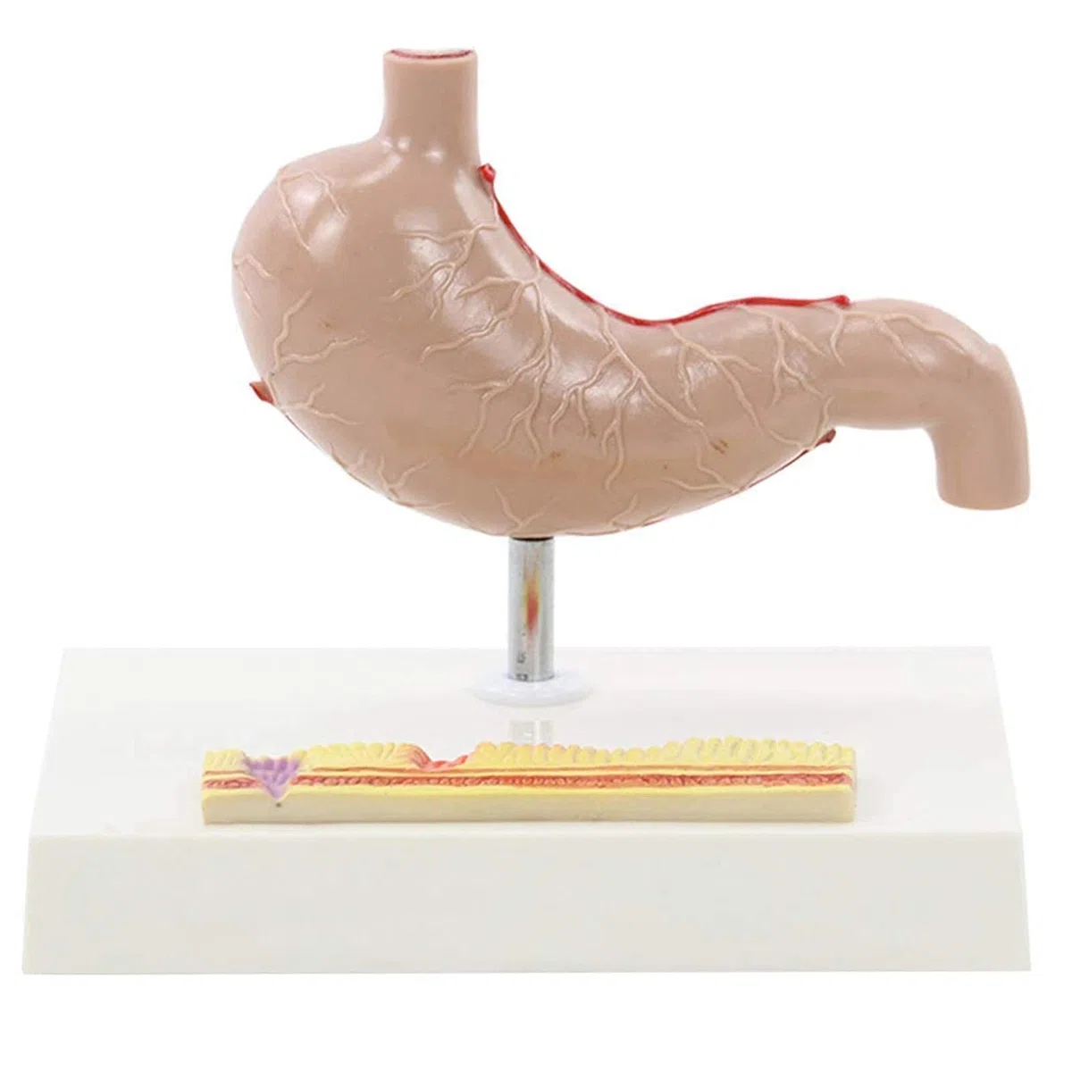 Modelos Anatómicos De Órganos Humanos - Modelos Anatómicos Gástricos De Tamaño Real - Ayudas Para La Enseñanza Y El Aprendizaje De La Autopsia De Comprensión De Problemas Gástricos - Suministros